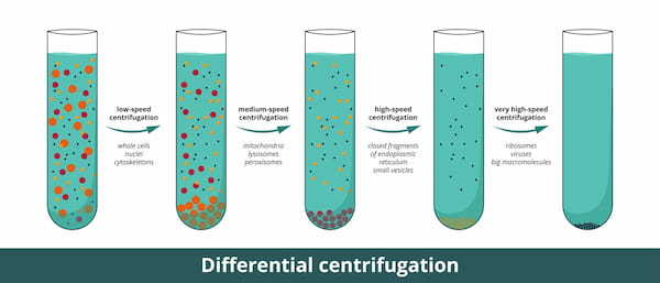 沈降 vs 遠心分離（リードタイム）
